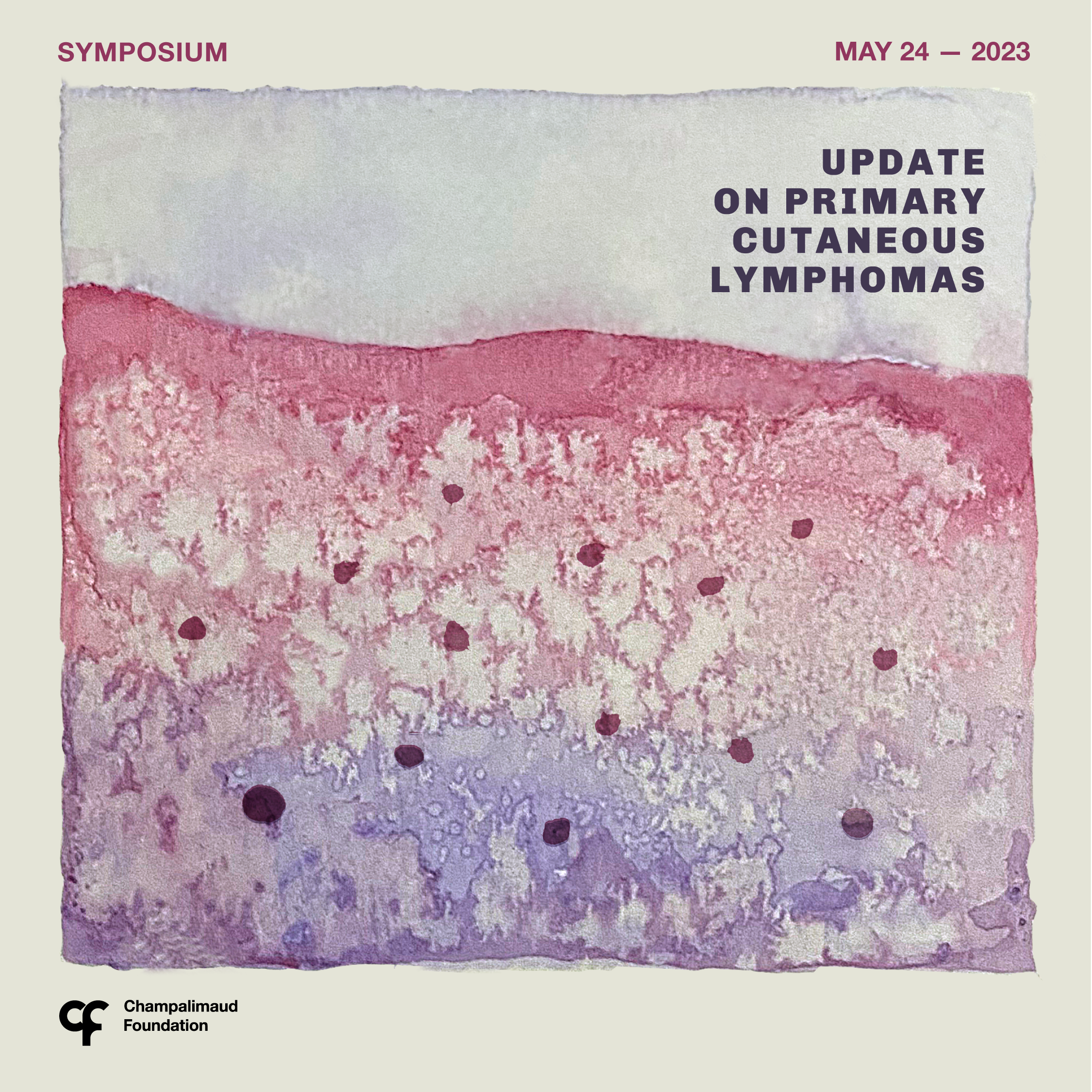 Symposium: Update on Primary Cutaneous Lymphomas
