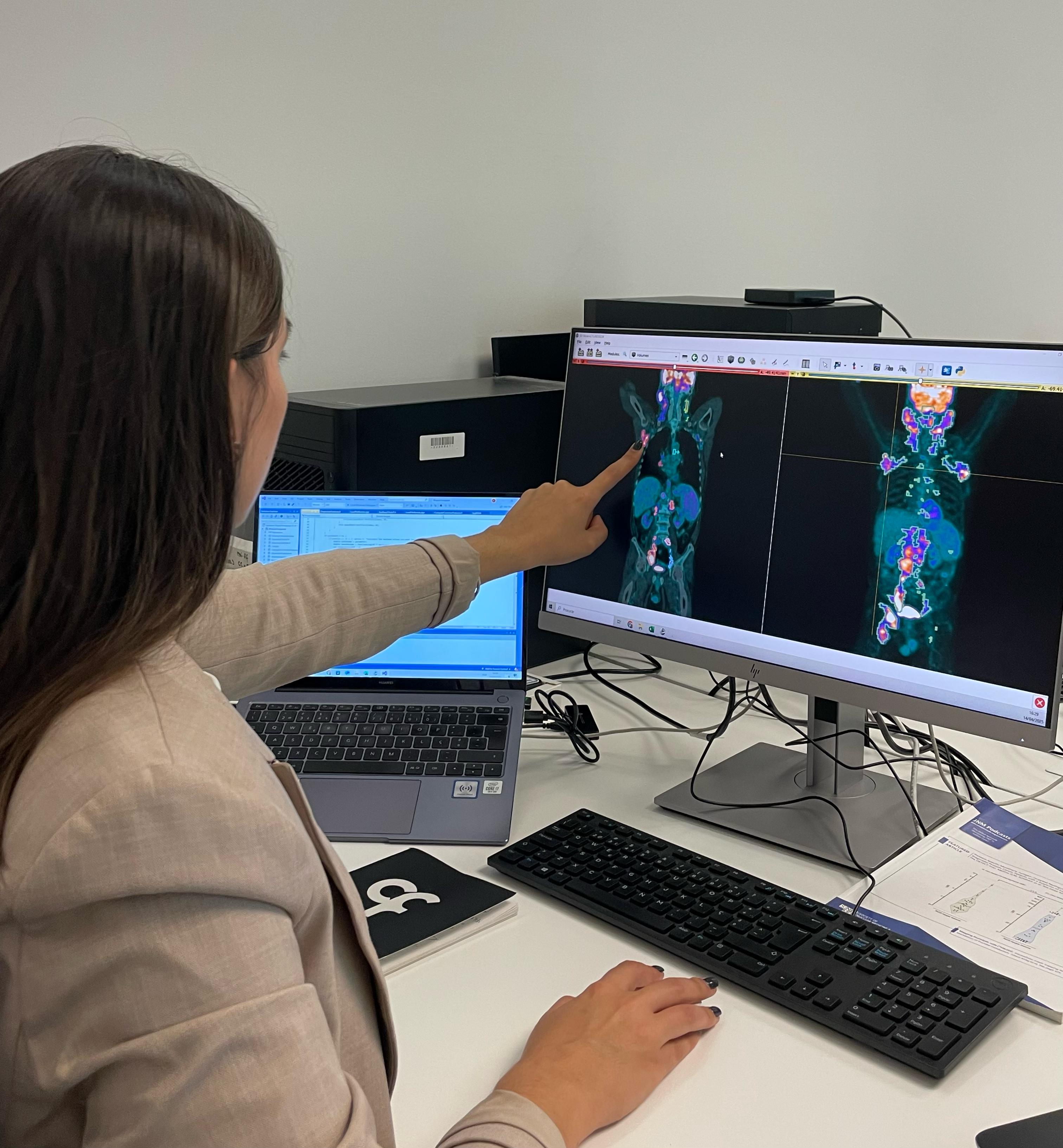Como a IA está a transformar a análise de PET/CT