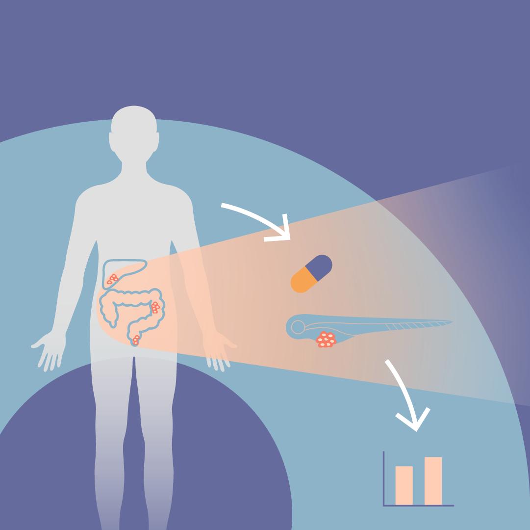 Estudo clínico mostra que "teste zAvatar" tem elevado poder preditivo para personalizar o tratamento do cancro colorrectal