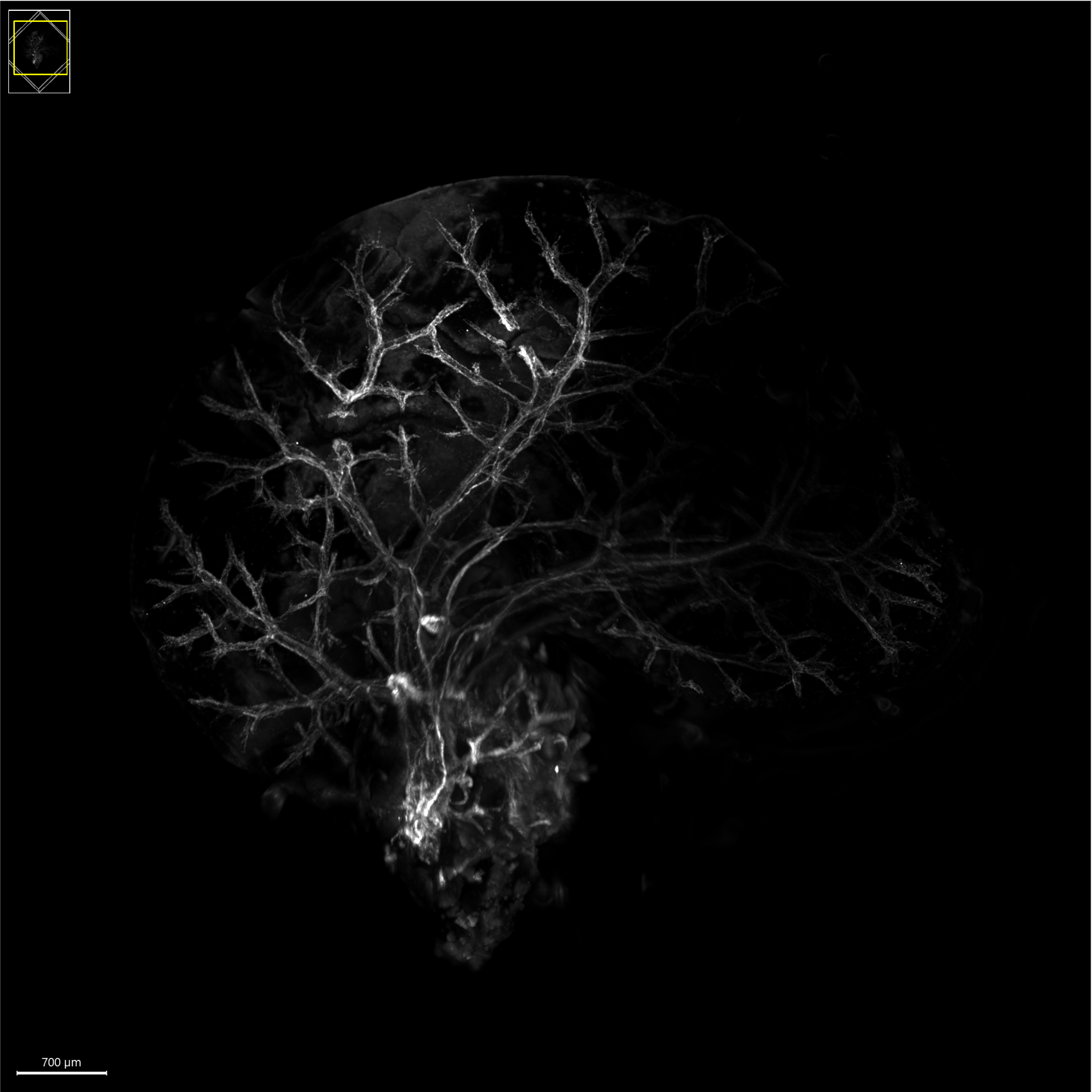 Champalimaud Foundation Researcher Awarded $1 Million to Study How the Body Keeps Cancer Asleep