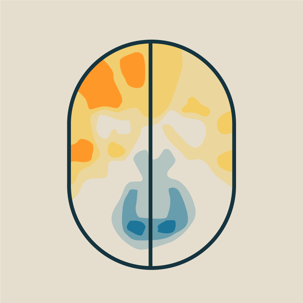 Mapeados circuitos cerebrais associados à mania